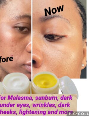 Day and Night Whitening and Lightning Cream for sunburn