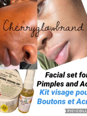 pic 202 Clear pimples/ Acne and lighten dark discoloration