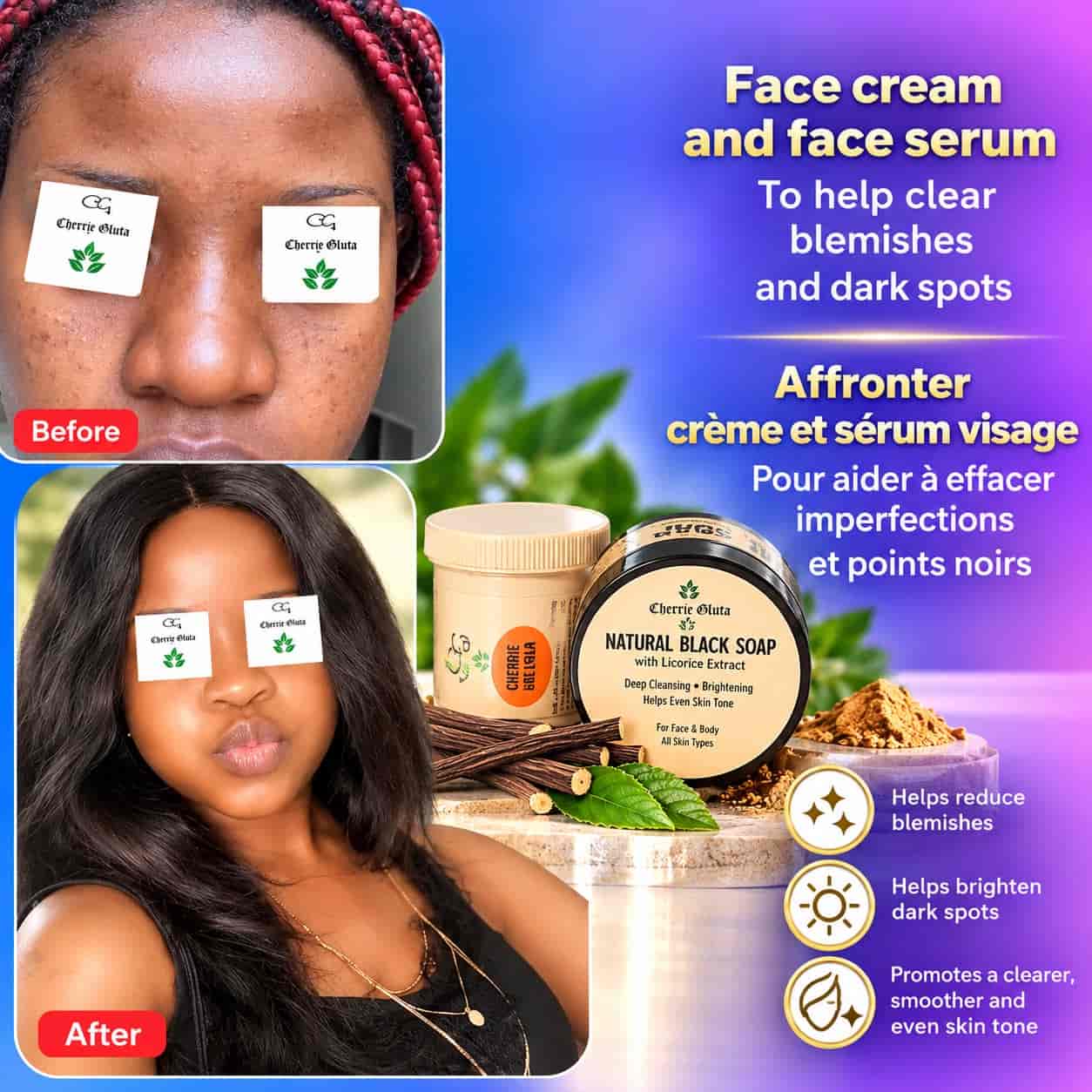 Pimples,Acne and Dark Spots Treatment (small size)